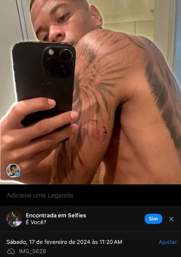 caio paulista alega ter sido mordido por sua ex-namorada Clara Monteiro (2)
