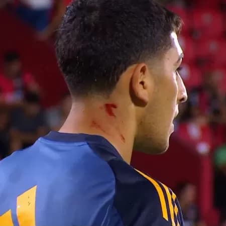 Leandro Brey, goleiro do Boca Juniors, foi alvejado por um pedaço de vidro arremessado pela torcida do Newell's Old Boys durante uma partida do Campeoanato Argentino (Foto: Reprodução)